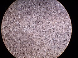 A layer of mesothelial cells grown in cell culture, featuring the typical "cobblestone" appearance.