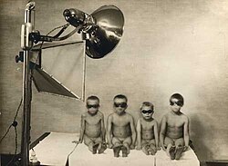 Tuberculosis phototherapy treatment in Kuopio, Finland, 1934