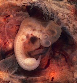 A 10 mm human embryo at 5 weeks