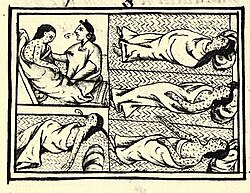 An illustration in Florentine Codex, compiled between 1540 and 1585 CE, depicting the Nahua peoples suffering from smallpox during the conquest-era in central Mexico