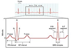 Electrocardiogram