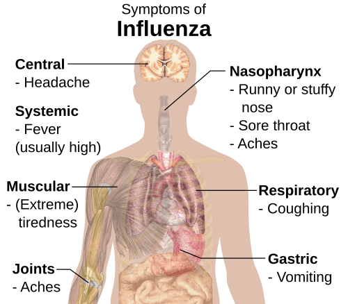 Symptoms of influenza,[2][3] with fever and cough the most common symptoms[4]