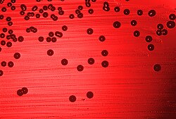 The first bacterial whole genome to be sequenced was of the bacterium Haemophilus influenzae.