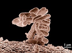 The bacterium Escherichia coli, commonly shortened to E. coli